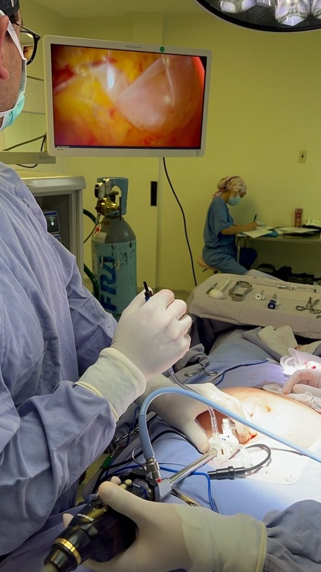 inguinal_laparoscópica