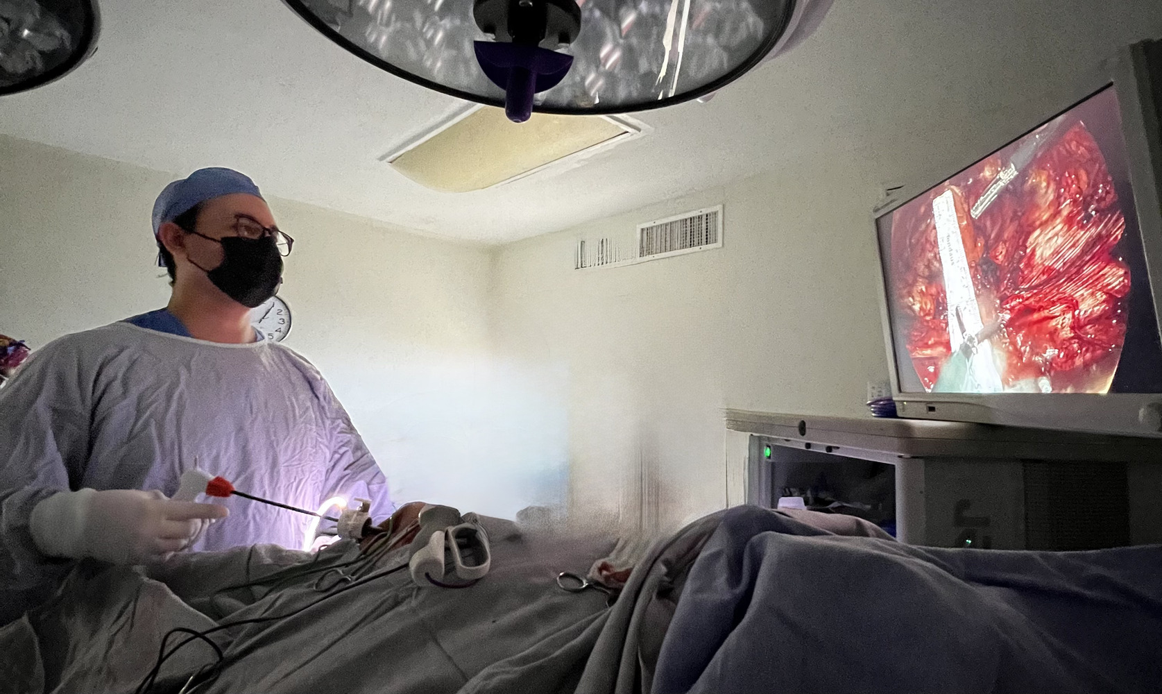 umbilical_laparoscópica